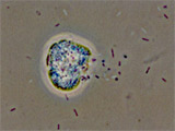 Legionella bacteria propagated inside an amoeba break out from the cell wall.