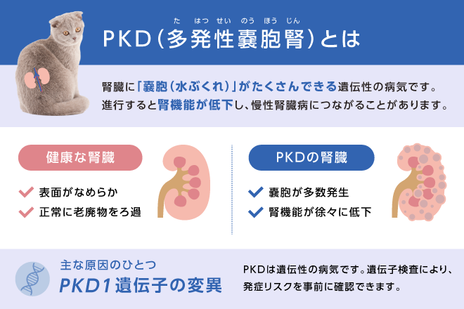 多発性嚢胞腎(PKD)とは